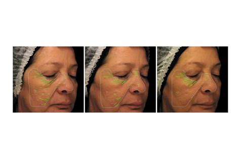 Centella Asiatica: Uses and Benefits For Skin Health - Miduty