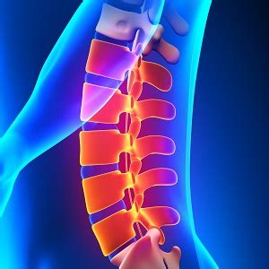 Best Spine Care Specialist in India-Non Surgical Back Pain Treatment in ...