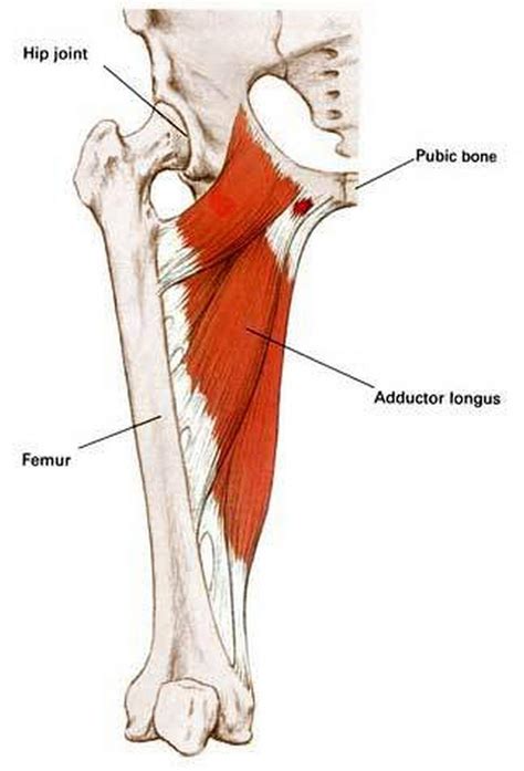 Hip Abductor Tendonitis at Ella Byatt blog