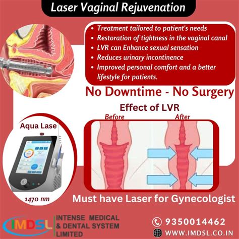 Improving Gynecology Practice using Laser Therapy