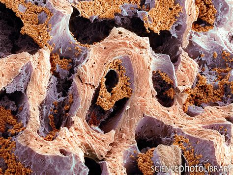 Scanning Electron Micrograph 的图像结果