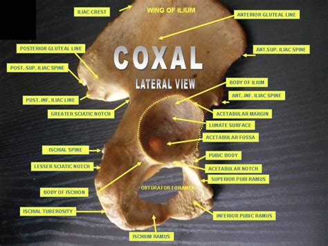 Anatomical Guide to the Hip Bone: A Detailed Lateral View Perspective - Anatomy Note
