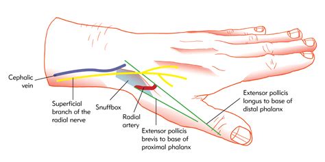 How to manage access via the distal radial route - Interventional News