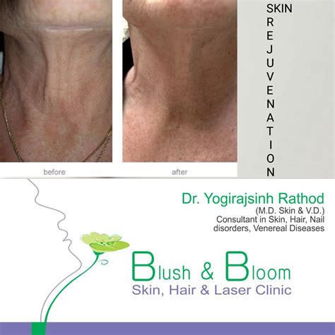 Blush & Bloom Clinic 8000512044 in Ahmedabad, India