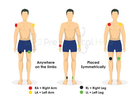 ECG Recording - Prehospital Hub