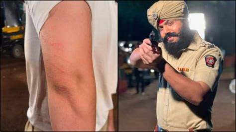 Raj Anadkat Bruises His Arms After Beating Himself With A Hunter While ...