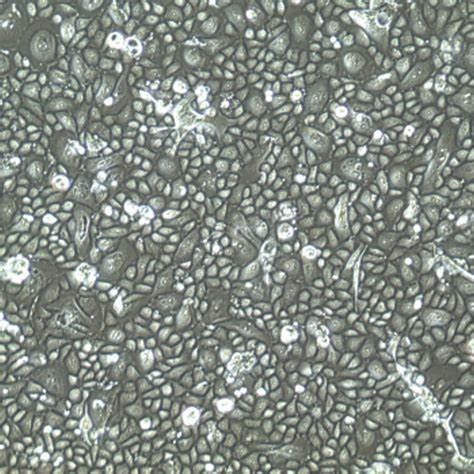 Image result for Endometrium Cell