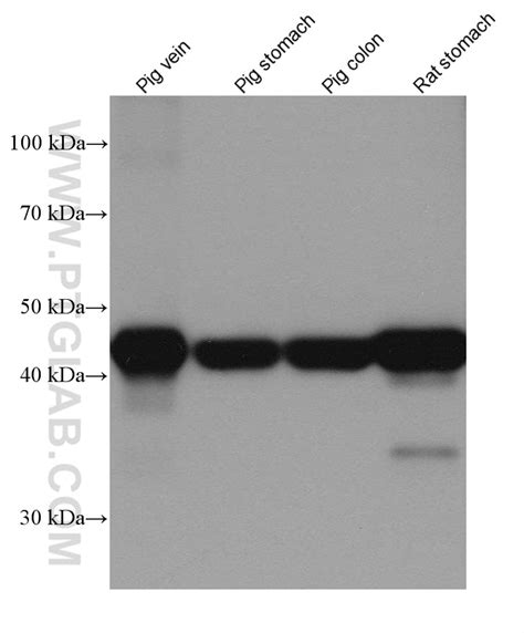 Alpha smooth muscle actin specific antibody (80008-1-PBS) | Proteintech