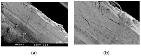 Peri-Implant Bone Damage Procured by Piezoelectric and Conventional ...
