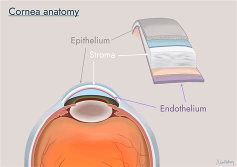 Superficial Keratectomy