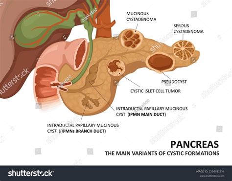 Pancreatic Duct