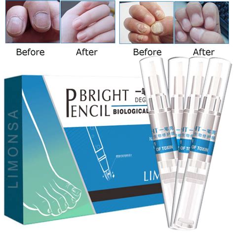 Buy 4Pcs Bright Pencil Nail Fungal Treatment Anti Fungus Biological Repair Solution at ...