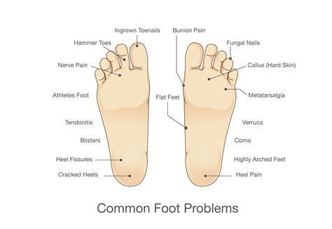 My Foot Aches On The Side Deals | emergencydentistry.com