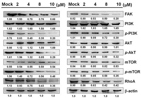Sinulariolide Inhibits Gastric Cancer Cell Migration and Invasion ...