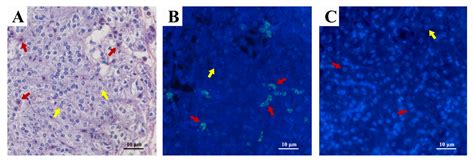 Identification of a Putative CFSH Receptor Inhibiting IAG Expression in ...