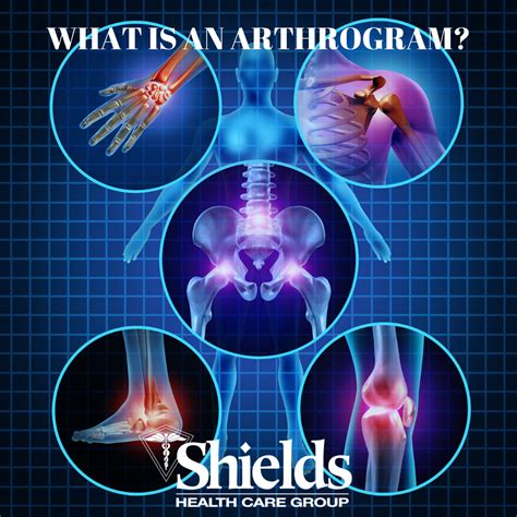 Image result for Back Arthrogram Technique