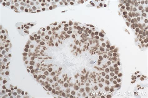 Mono/Di/Tri-Methyl-Histone H3 (Lys4) antibody (84908-1-PBS) | Proteintech