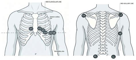 Exercise Stress Testing in Clinical Cardiology: A Practical Guide to ...