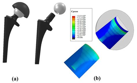 The Influence of Assembly Force on the Material Loss at the Metallic ...