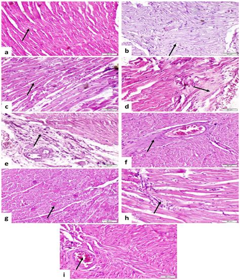 Unveiling the Potential of Silymarin, Spirulina platensis, and ...