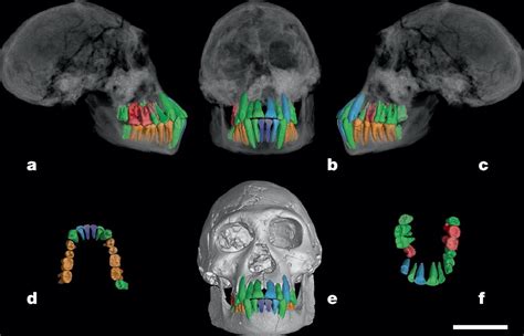 Scientists Found an Unexpected Sign of Human Longevity—Our Teeth
