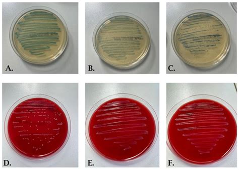 Prevalence and Antibiotic Resistance of Streptococcus agalactiae in ...