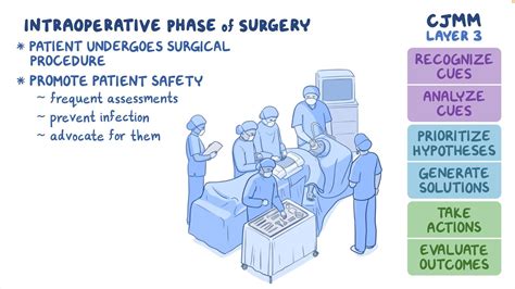 Intraoperative Procedures at Richard Day blog