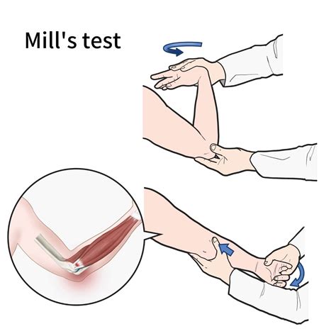 Tennis Elbow Test
