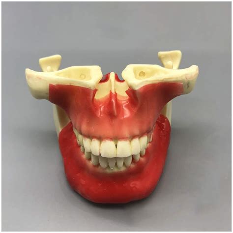 Buy FHUILI Teeth Model Maxillary Im Model - Dental Practice Model of ...
