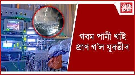 ওজন হ্ৰাস কৰাৰ চেষ্টাই হ’ল কাল