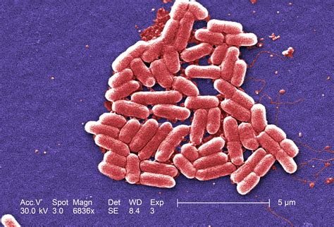 Free picture: gram, negative, Escherichia, Coli, bacteria