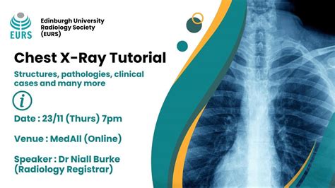 Image result for Chest X-Ray Tutorial