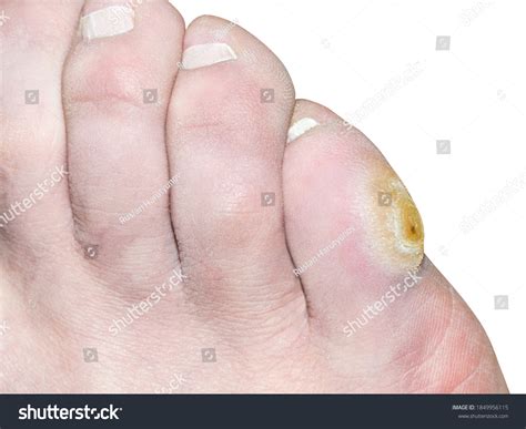 5,745 imágenes de Corn on foot - Imágenes, fotos y vectores de stock | Shutterstock