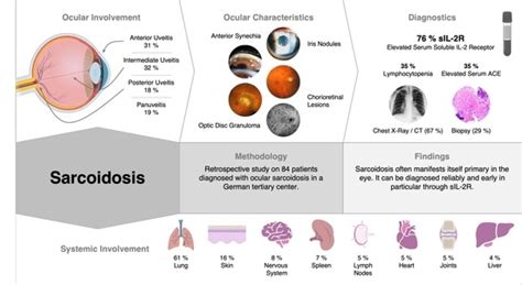 Findings and Graduation of Sarcoidosis-Related Uveitis: A Single-Center ...
