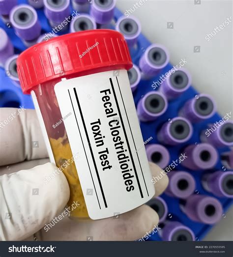 Image result for Feces Sample