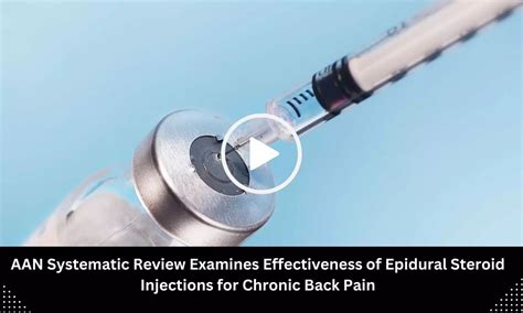 AAN Systematic Review Examines Effectiveness of Epidural Steroid ...