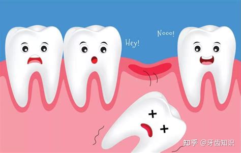 牙齿松动还能恢复或拔牙 - 知乎