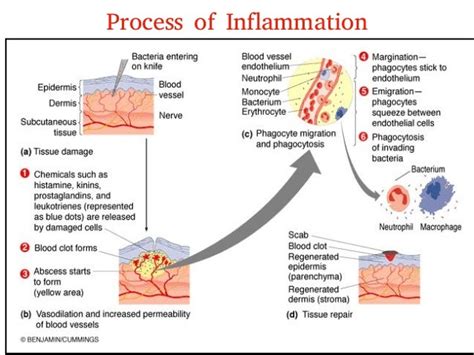 Inflammation Process Steps 的图像结果