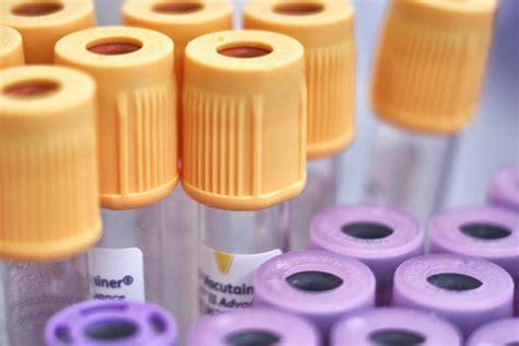 What Is Blood Test C3 C4 at Leta Tabor blog