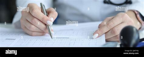 Cardiogram Procedure 的图像结果