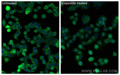 Phospho-P53 (Ser46) antibody (CL488-67900) | Proteintech