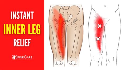 Leg Pain Down Side Of Thigh at James Browning blog