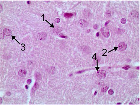 Subchronic Toxicity of Copper Oxide Nanoparticles and Its Attenuation ...