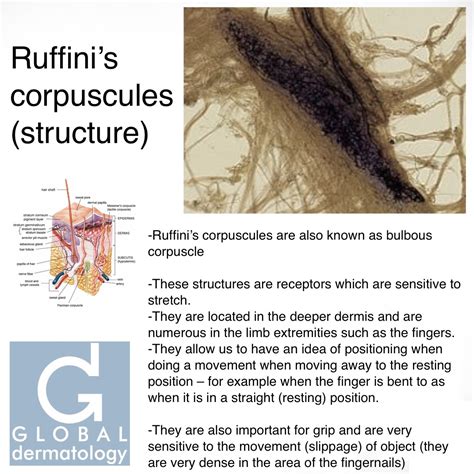 Global Dermatology » Ruffini’s Corpuscle (structure) (Instagram)