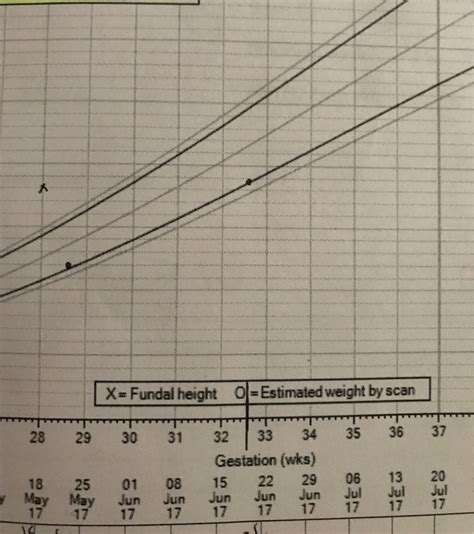 Size of baby at 34 weeks growth scan?