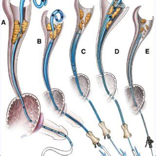 Image result for Patient Bad Example