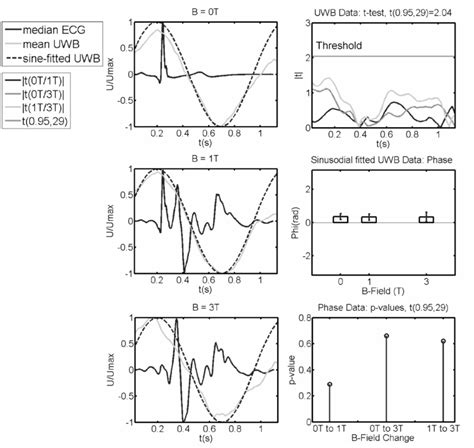 Ultra-Wideband Sensors for Improved Magnetic Resonance Imaging ...