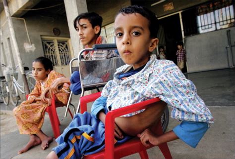 Bildergebnis für pictures of uranium depleted in children in iraq truthout