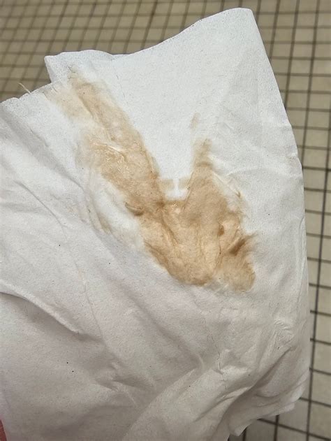 Light Brown Discharge Early Pregnancy