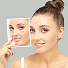 Matra Haldi Chandan Ubtan Ayurvedic Paste Face Pack for Skin ...